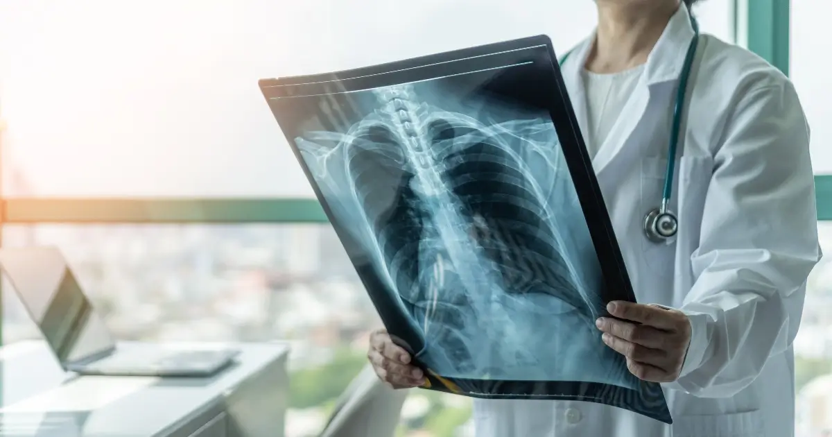 Asbestos Disease Claims